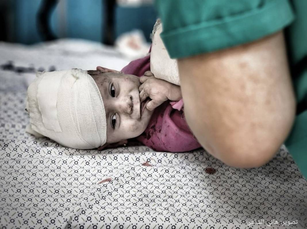 Fotoğraflarla Gazze'de yaralanan çocuklar: 'İnsanlık felaketi yaşanıyor' 8
