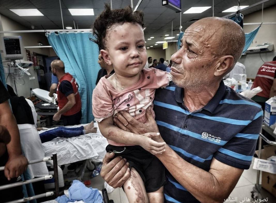 Fotoğraflarla Gazze'de yaralanan çocuklar: 'İnsanlık felaketi yaşanıyor' 7