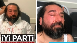 İYİ Parti'li Metin Bozkurt'a öldüresiye saldırdılar!