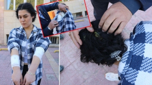 Üniversiteli Kübra'ya Okula Giderken Köpekler Saldırdı
