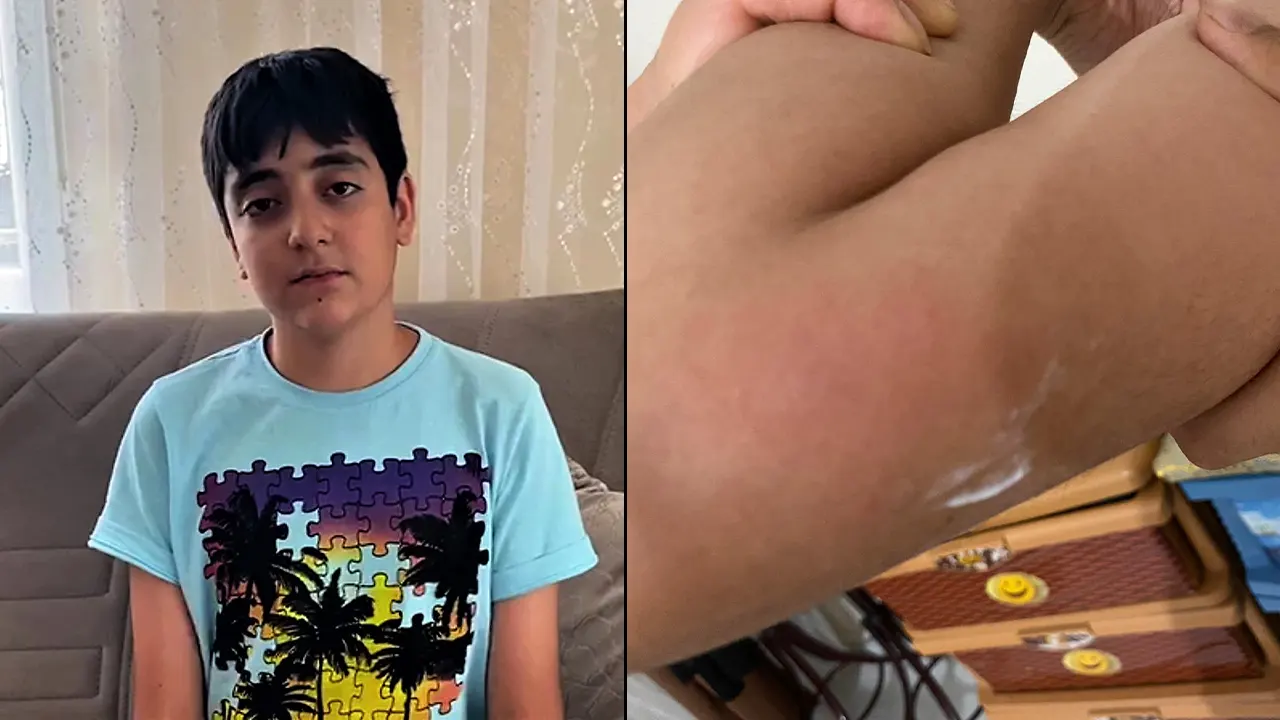 Torpil faciası: Balkona atılan torpil 13 yaşındaki çocuğu yaraladı