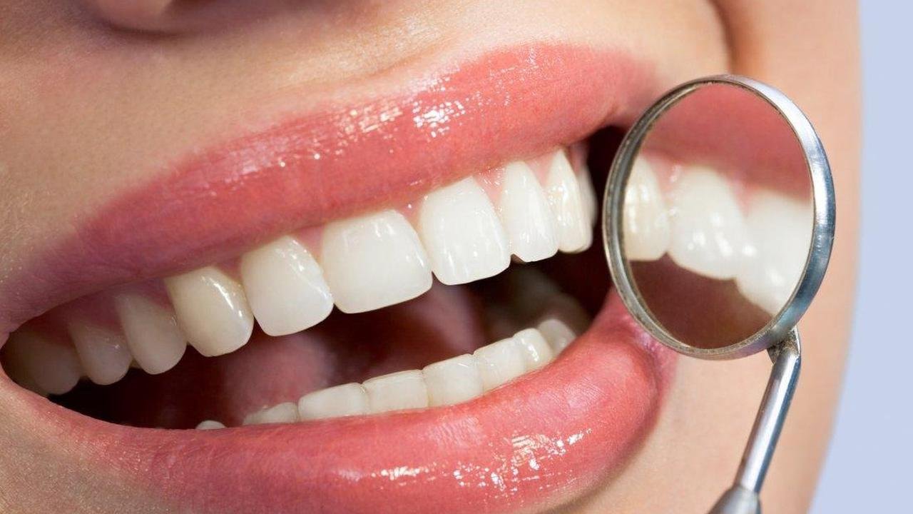2023 Zirkonyum diş fiyatları, diş yaptırmak ne kadar, kaç TL?