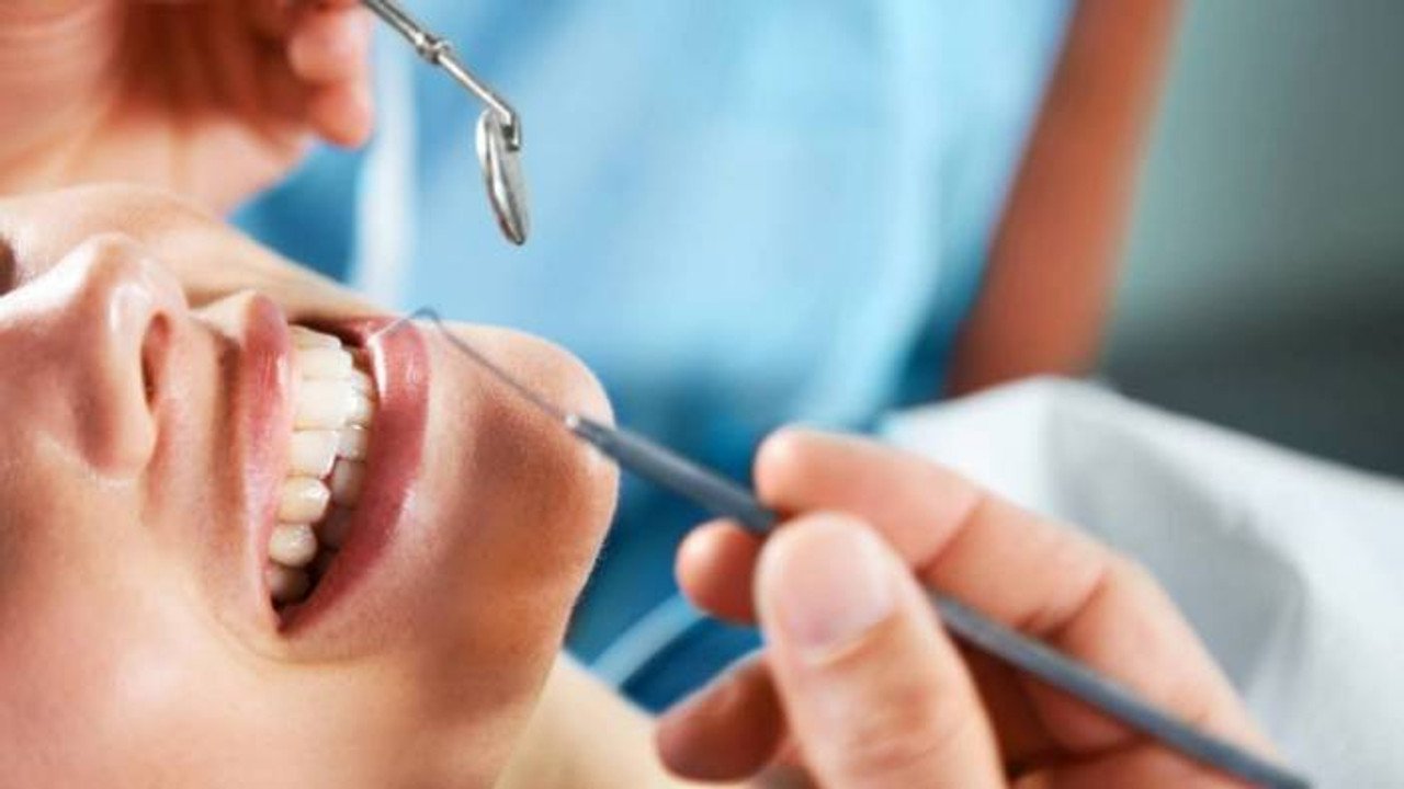 2023 20'lik diş çekim güncel fiyatları, özelde diş çektirmek kaç TL?