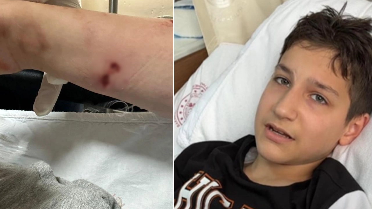 12 yaşındaki çocuk sevdiği köpeğin saldırısına uğradı