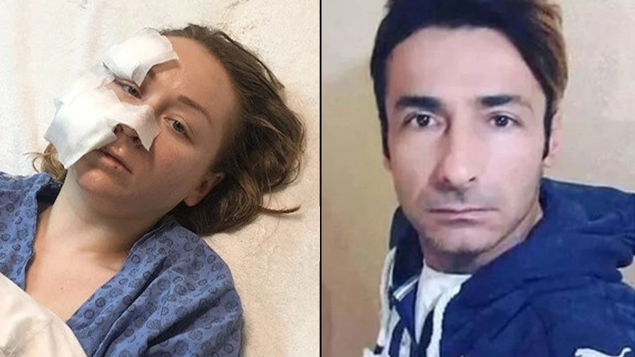 Boşanmak isteyen Ukraynalı eşinin yüzünü falçatayla kesen sanığa 20 yıl hapis