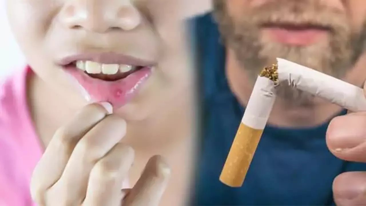 Sigara içenler dikkat! Ağız kanseri olma riskiniz çok yüksek