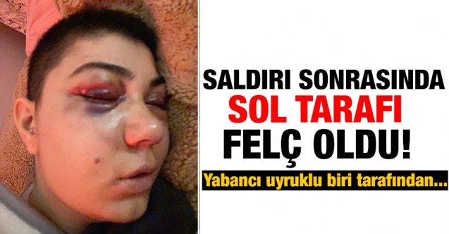 Beyoğlu'nda tanımadığı biri tarafından saldırıya uğradı