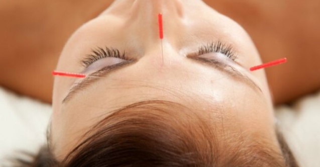 Akupunktur hamile kadınlarda ağrıyı hafifletiyor